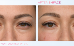 Emface_PIC_Ba-card-female-eyes-159_ENUS100