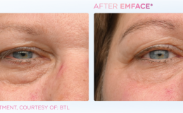 Emface_PIC_Ba-card-female-eyes-162_ENUS100