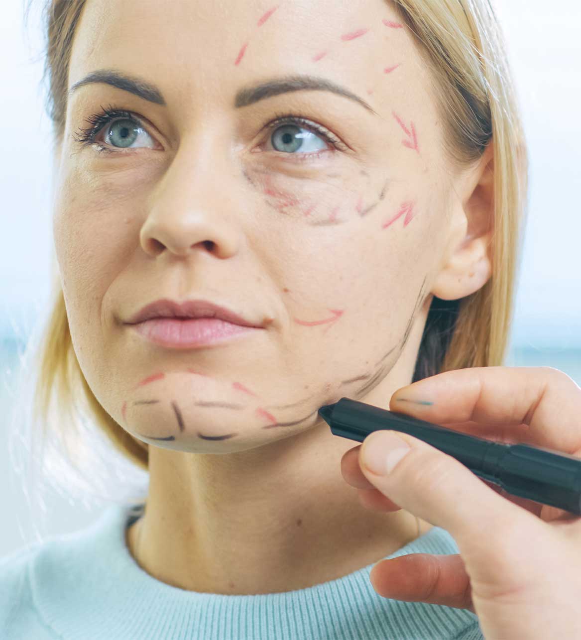 Ellacor Non-surgical option